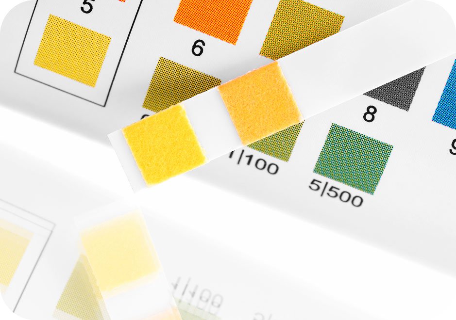 Colored fabric pH testing strips.